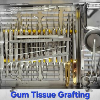Tissue Grafting